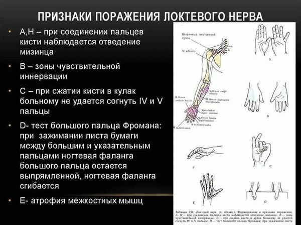 Трудоспособность после травмы кисти: что нужно знать